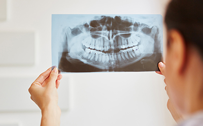 dental x-ray