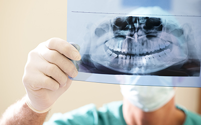 Dentist examining x-ray