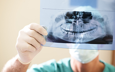 Dentist examining x-ray
