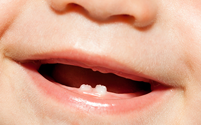 Boy with baby teeth