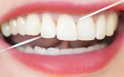 Woman's teeth with dental floss