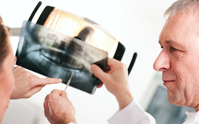 picture of a dentist holding up an x-ray